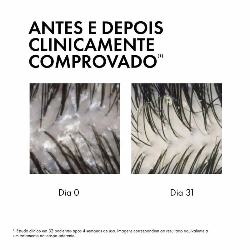 Sérum 10 Vichy Dercos Anticaspa 100ml